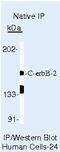 ERBB2 antibody, MA5-13675, Invitrogen Antibodies, Immunoprecipitation image 