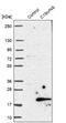 Chromosome 19 Open Reading Frame 48 antibody, NBP1-81210, Novus Biologicals, Western Blot image 