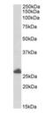 Tripartite Motif Containing 61 antibody, orb18488, Biorbyt, Western Blot image 