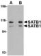 SATB Homeobox 1 antibody, MBS150491, MyBioSource, Western Blot image 