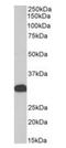 Four And A Half LIM Domains 1 antibody, orb389366, Biorbyt, Western Blot image 