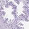 Gamma-sarcoglycan antibody, HPA007476, Atlas Antibodies, Immunohistochemistry paraffin image 