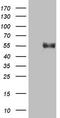 Beta-1,4-Galactosyltransferase 3 antibody, TA808622, Origene, Western Blot image 
