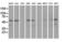 Katanin Catalytic Subunit A1 Like 1 antibody, LS-C337265, Lifespan Biosciences, Western Blot image 