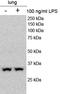 Phospholipid Scramblase 3 antibody, NBP1-52866, Novus Biologicals, Western Blot image 