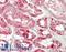 ELOVL Fatty Acid Elongase 1 antibody, LS-B13651, Lifespan Biosciences, Immunohistochemistry paraffin image 