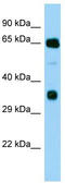Phenylalanyl-TRNA Synthetase Subunit Beta antibody, TA332059, Origene, Western Blot image 