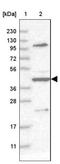 Tripartite Motif Containing 54 antibody, NBP1-92154, Novus Biologicals, Western Blot image 