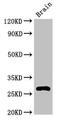 DnaJ Heat Shock Protein Family (Hsp40) Member C4 antibody, CSB-PA865087LA01HU, Cusabio, Western Blot image 