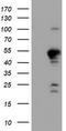 Protein Phosphatase 1 Regulatory Subunit 15A antibody, TA504313, Origene, Western Blot image 