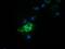 3-Hydroxyisobutyryl-CoA Hydrolase antibody, GTX84368, GeneTex, Immunofluorescence image 