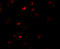 Rab Interacting Lysosomal Protein antibody, 6791, ProSci Inc, Immunofluorescence image 