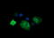 Cancer/Testis Antigen 1B antibody, LS-C174392, Lifespan Biosciences, Immunofluorescence image 