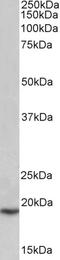Slc39a1 antibody, 43-658, ProSci, Western Blot image 