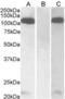 Furin, Paired Basic Amino Acid Cleaving Enzyme antibody, AHP2262, Bio-Rad (formerly AbD Serotec) , Enzyme Linked Immunosorbent Assay image 