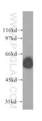 Gamma-Aminobutyric Acid Type A Receptor Gamma1 Subunit antibody, 12871-1-AP, Proteintech Group, Western Blot image 