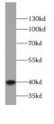 CK-19 antibody, FNab02210, FineTest, Western Blot image 