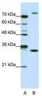 Exosome complex exonuclease RRP4 antibody, TA343807, Origene, Western Blot image 