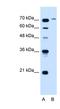 GST antibody, NBP1-59898, Novus Biologicals, Western Blot image 