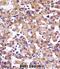Sulfotransferase 1A3/1A4 antibody, abx028284, Abbexa, Immunohistochemistry frozen image 
