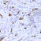Lymphocyte Specific Protein 1 antibody, LS-C334170, Lifespan Biosciences, Immunohistochemistry paraffin image 