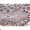 Villin 1 antibody, LS-C813573, Lifespan Biosciences, Immunohistochemistry paraffin image 