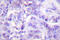 Hdm2 antibody, LS-C177978, Lifespan Biosciences, Immunohistochemistry frozen image 