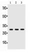 Adiponectin, C1Q And Collagen Domain Containing antibody, PB9001, Boster Biological Technology, Western Blot image 