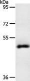 Spermatogenesis-associated protein 17 antibody, PA5-50273, Invitrogen Antibodies, Western Blot image 