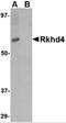 Mex-3 RNA Binding Family Member A antibody, 4869, ProSci, Western Blot image 