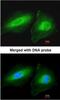 Coiled-Coil Domain Containing 83 antibody, NBP1-32738, Novus Biologicals, Immunofluorescence image 
