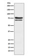 Protein Kinase C Epsilon antibody, M01151, Boster Biological Technology, Western Blot image 