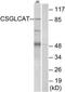 Chondroitin Polymerizing Factor 2 antibody, TA315526, Origene, Western Blot image 