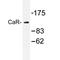 Calcium Sensing Receptor antibody, AP20293PU-N, Origene, Western Blot image 