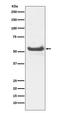 Mitogen-Activated Protein Kinase 10 antibody, M04297, Boster Biological Technology, Western Blot image 