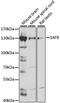 Scaffold Attachment Factor B antibody, A7927, ABclonal Technology, Western Blot image 