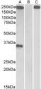 Thrombospondin 1 antibody, TA326718, Origene, Western Blot image 