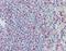 CD70 Molecule antibody, orb96688, Biorbyt, Immunohistochemistry paraffin image 