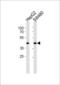 Alcohol Dehydrogenase 7 (Class IV), Mu Or Sigma Polypeptide antibody, 64-074, ProSci, Western Blot image 