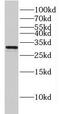 Gap Junction Protein Beta 3 antibody, FNab03467, FineTest, Western Blot image 
