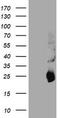 Metalloproteinase inhibitor 2 antibody, TA504043AM, Origene, Western Blot image 