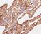 Epithelial Cell Adhesion Molecule antibody, V7241-100UG, NSJ Bioreagents, Immunohistochemistry paraffin image 