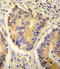 ADH4 antibody, LS-C156087, Lifespan Biosciences, Immunohistochemistry frozen image 
