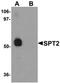 Serine Palmitoyltransferase Long Chain Base Subunit 2 antibody, orb75610, Biorbyt, Western Blot image 