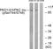 Protein Kinase D1 antibody, PA5-38386, Invitrogen Antibodies, Western Blot image 