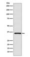 Doublesex And Mab-3 Related Transcription Factor 1 antibody, M02311, Boster Biological Technology, Western Blot image 