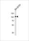 Prospero homeobox protein 1 antibody, 60-973, ProSci, Western Blot image 