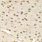 Chromobox 8 antibody, LS-C334571, Lifespan Biosciences, Immunohistochemistry paraffin image 