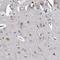 Galactosidase Beta 1 Like 3 antibody, HPA039916, Atlas Antibodies, Immunohistochemistry paraffin image 