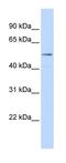 Histone-lysine N-methyltransferase SUV420H1 antibody, orb324551, Biorbyt, Western Blot image 